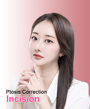 Ptosis