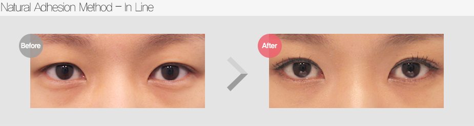 Before & After