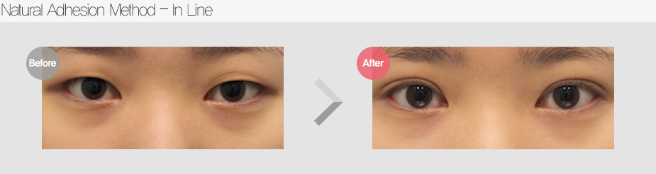 Before & After