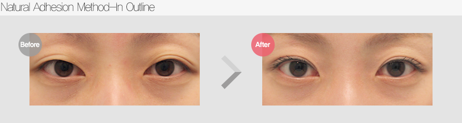 Before & After