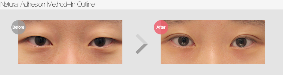 Before & After