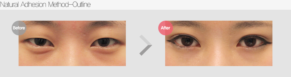 Before & After