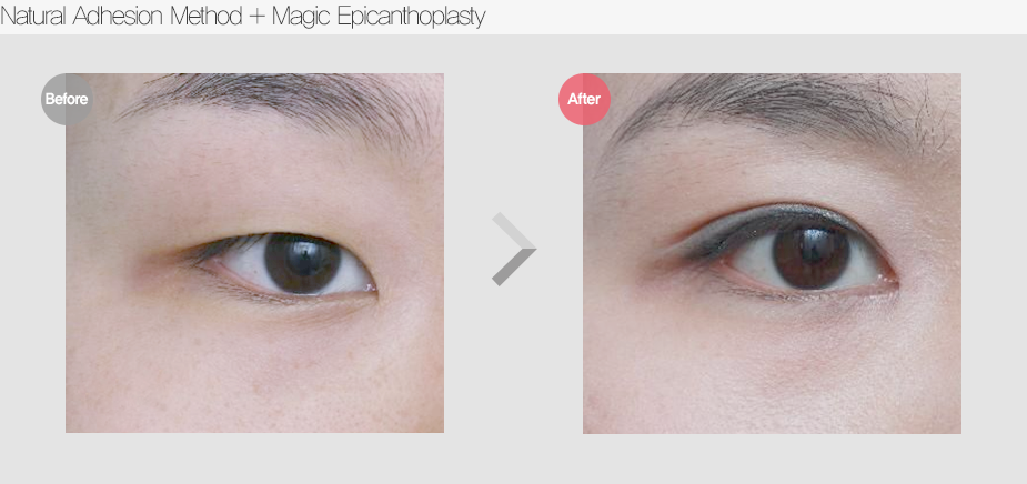Before & After