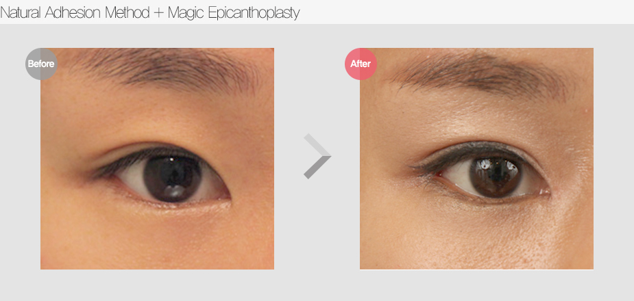 Before & After