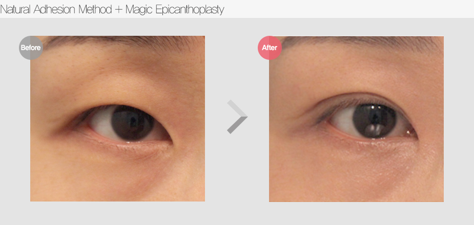 Before & After