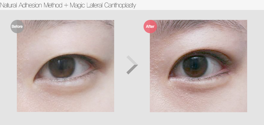 Before & After