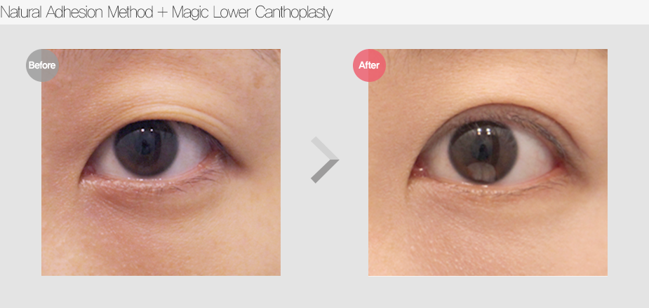 Before & After