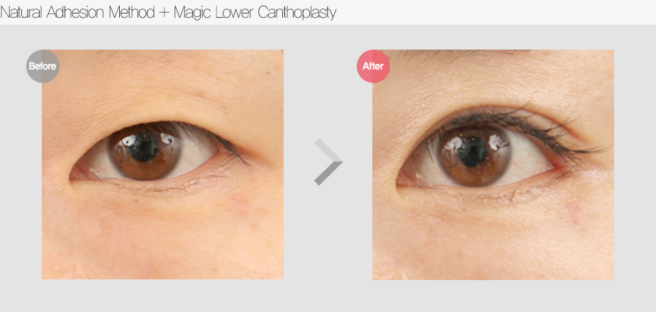 Before & After