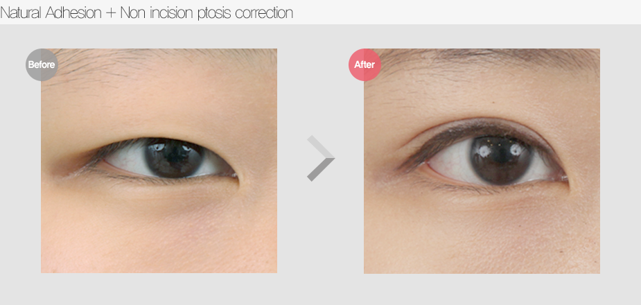 Before & After