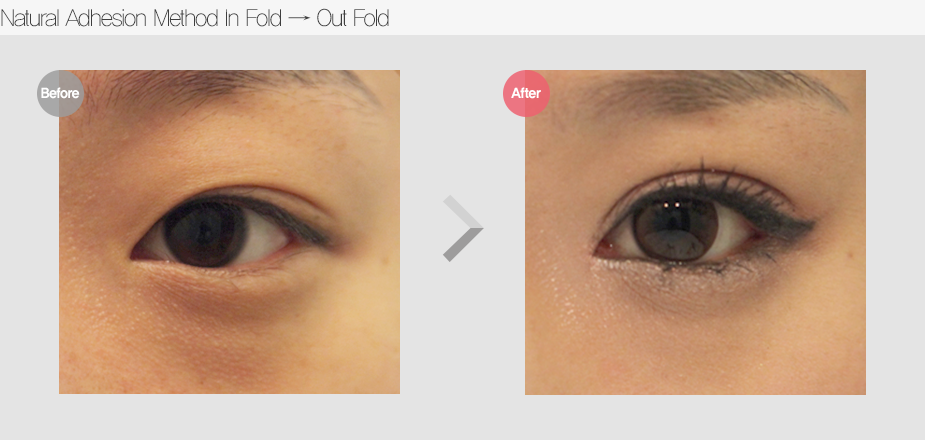 Before & After
