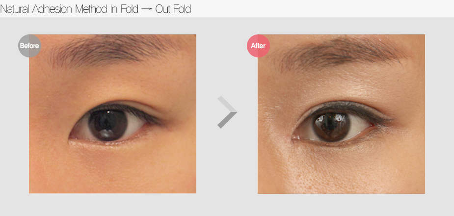 Before & After