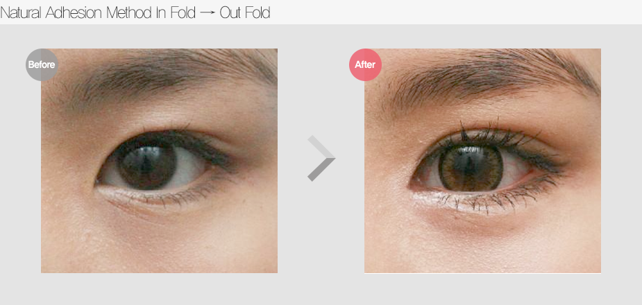 Before & After