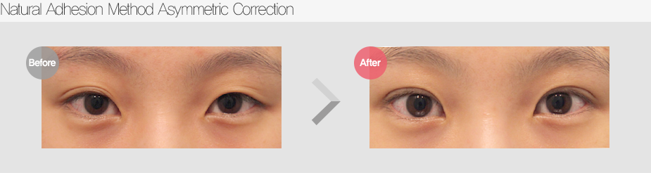 Before & After
