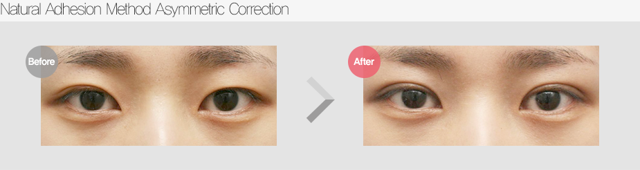 Before & After