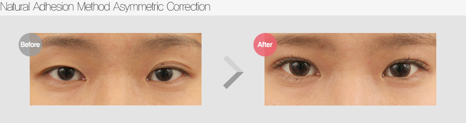 Before & After