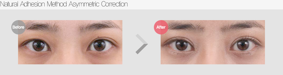 Before & After