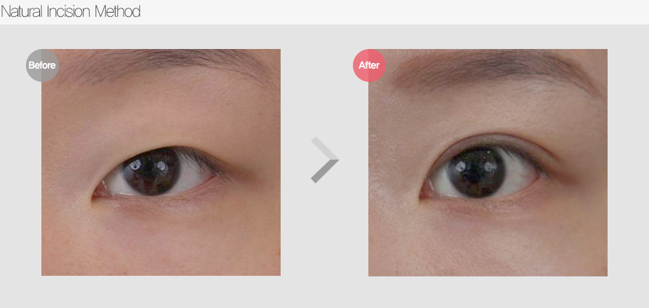 Before & After