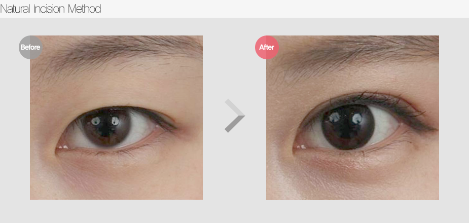 Before & After