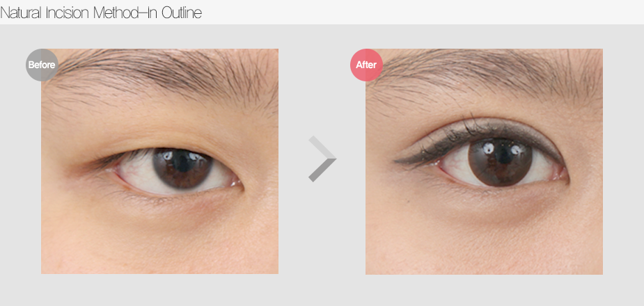 Before & After