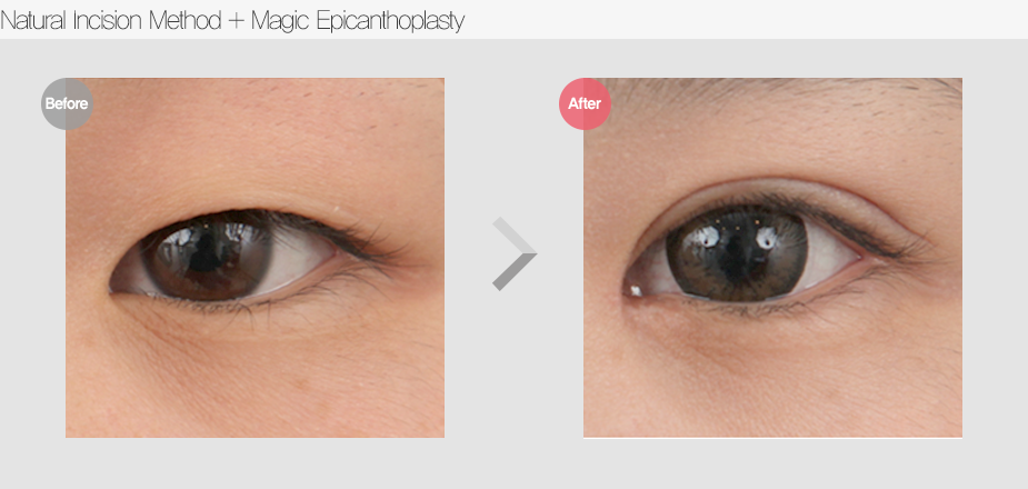 Before & After