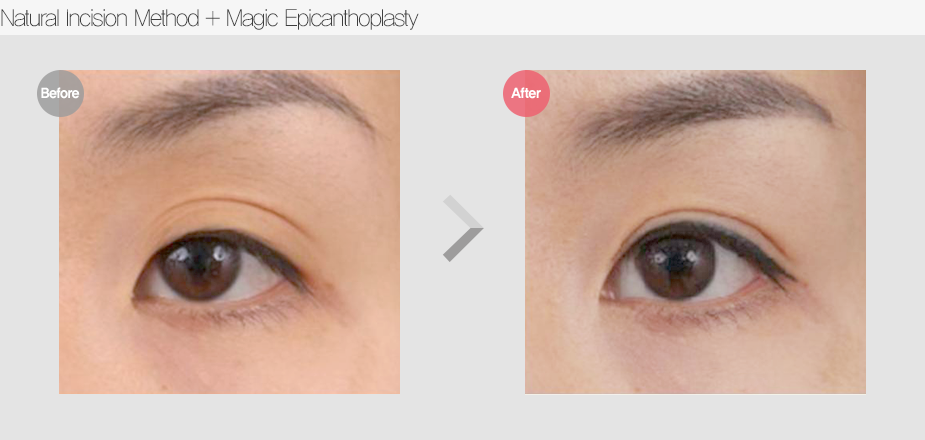 Before & After