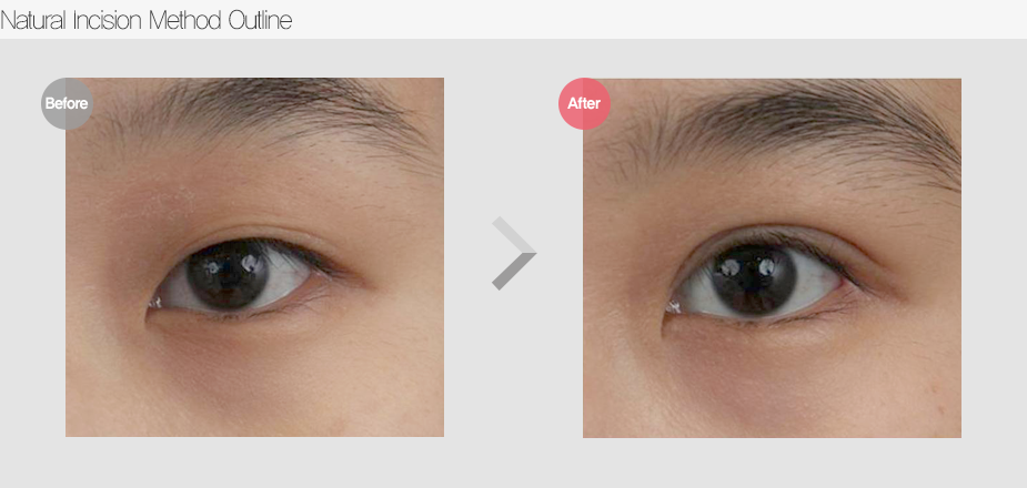 Before & After
