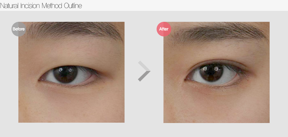 Before & After