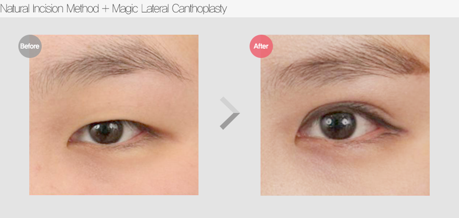 Before & After