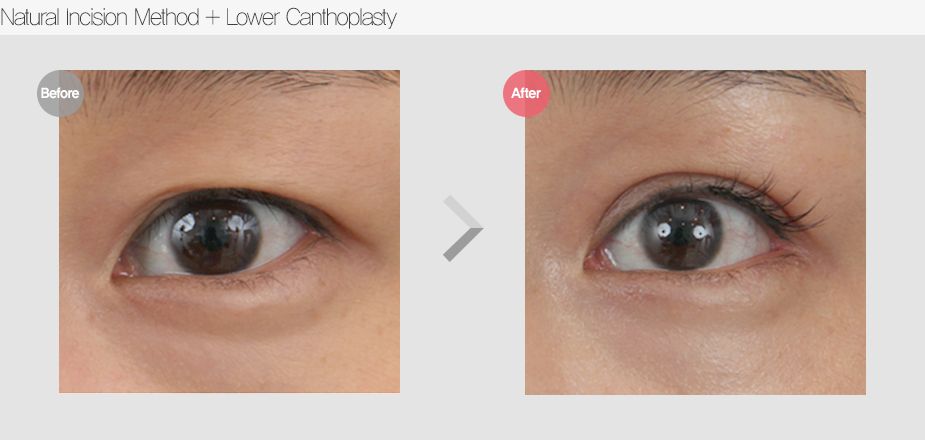 Before & After
