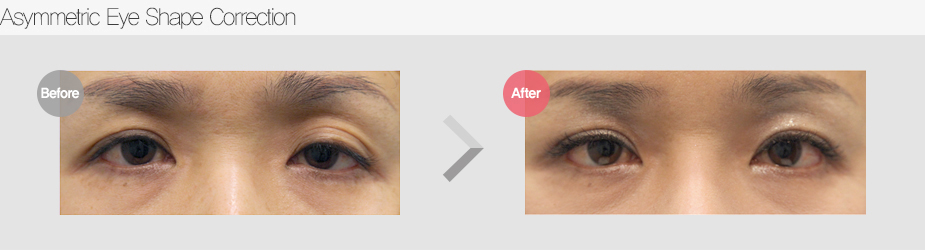 Before & After Pictures
