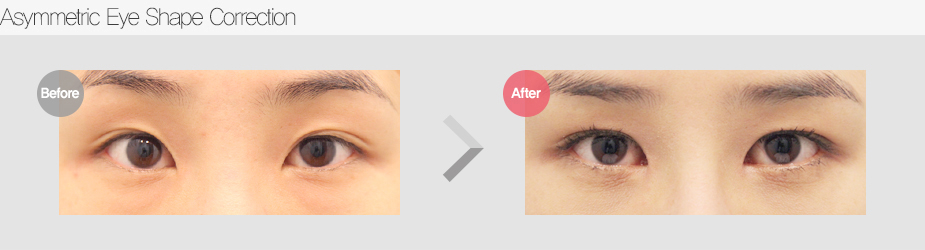 Before & After Pictures