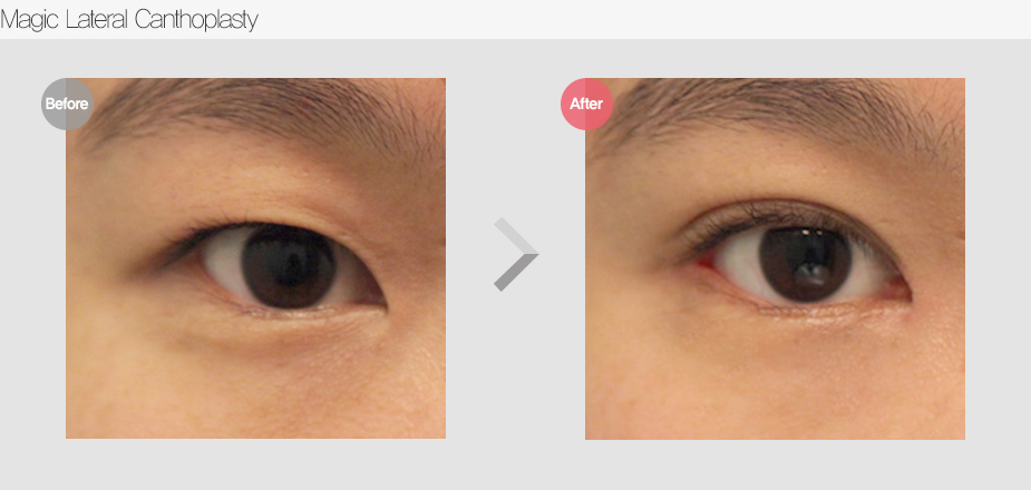 Before & After