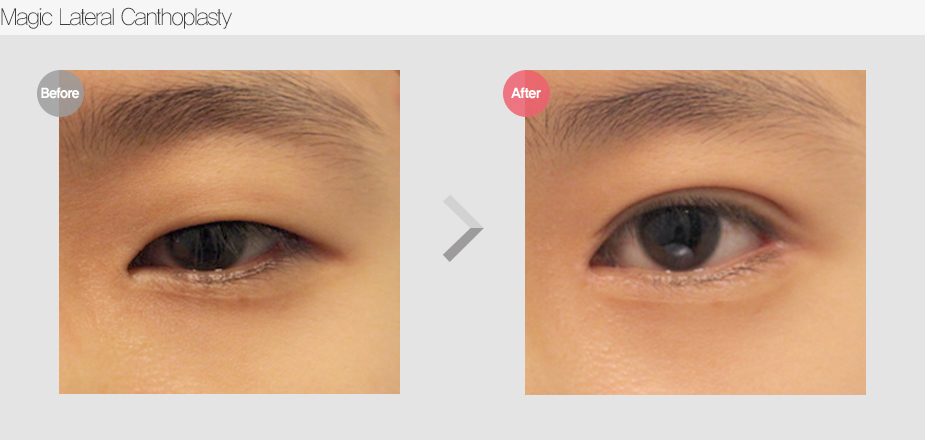 Before & After