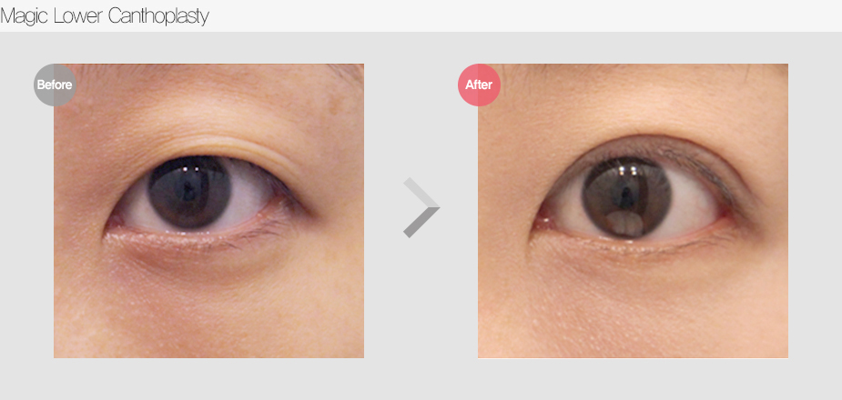 Before & After Pictures