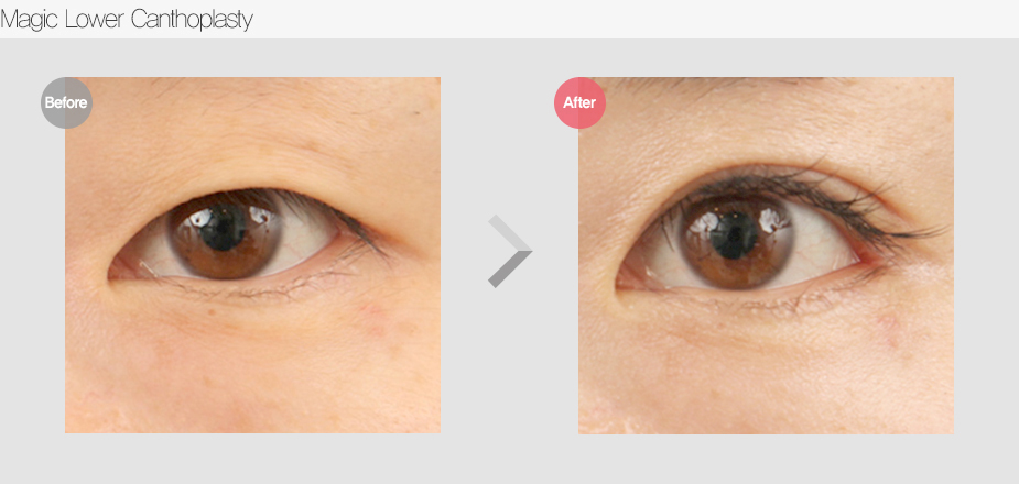 Before & After Pictures