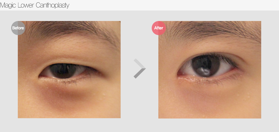 Before & After Pictures