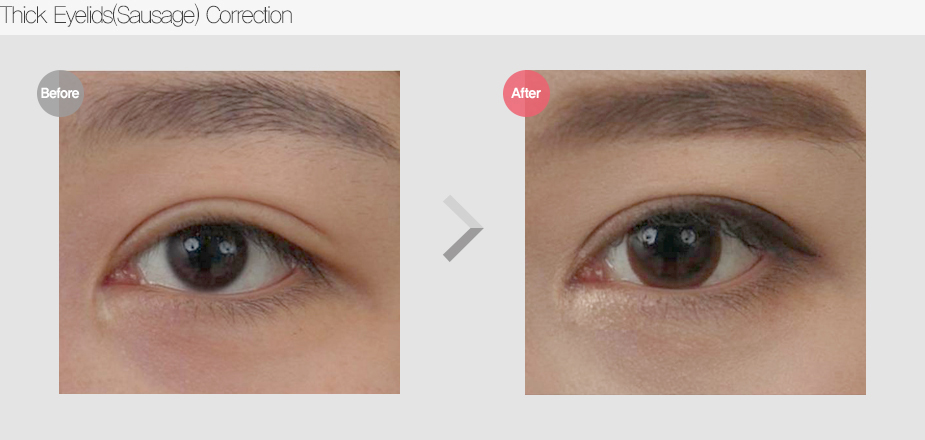 Before & After