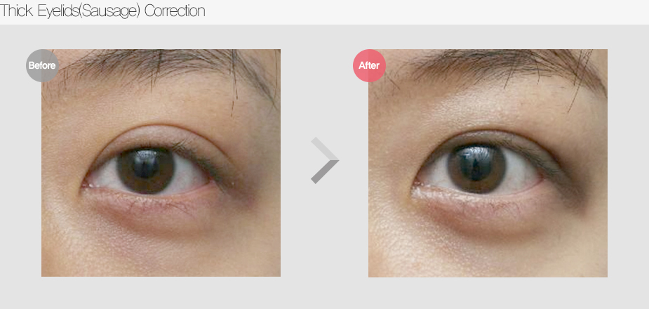 Before & After