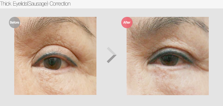 Before & After