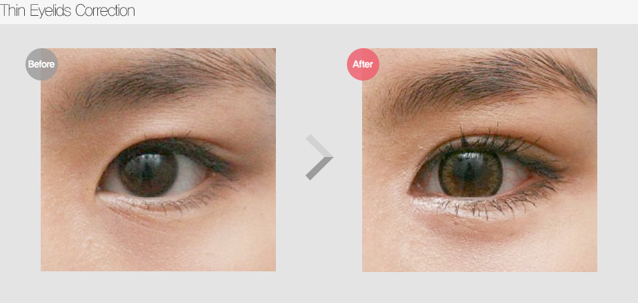 Before & After