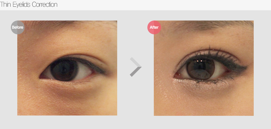 Before & After