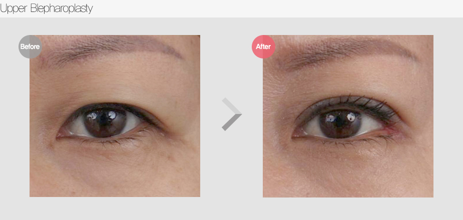Before & After