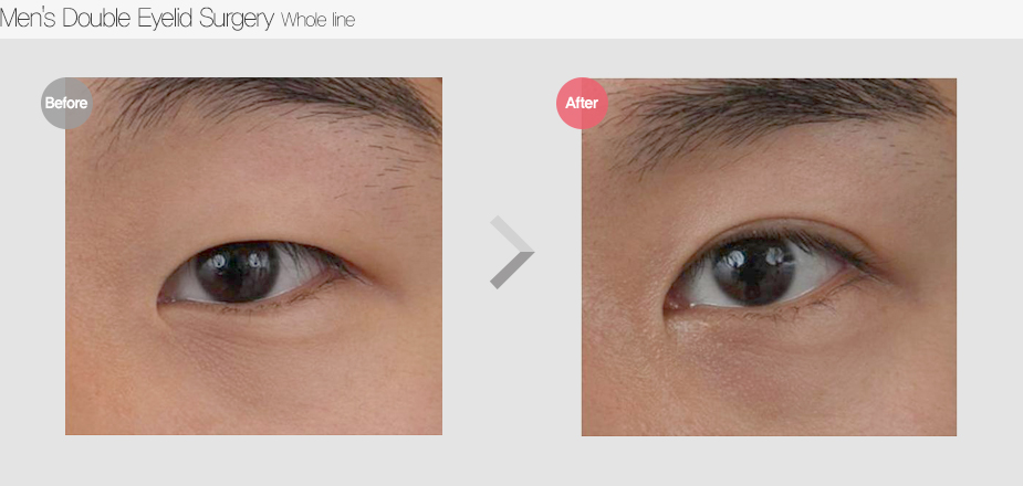 Before & After