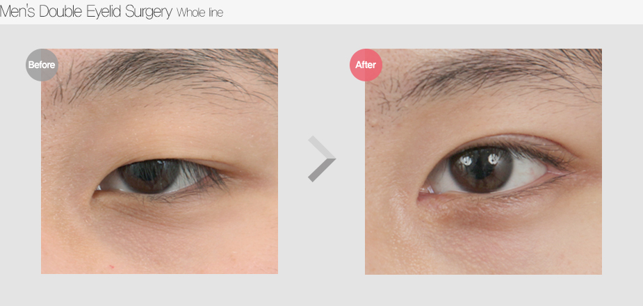 Before & After