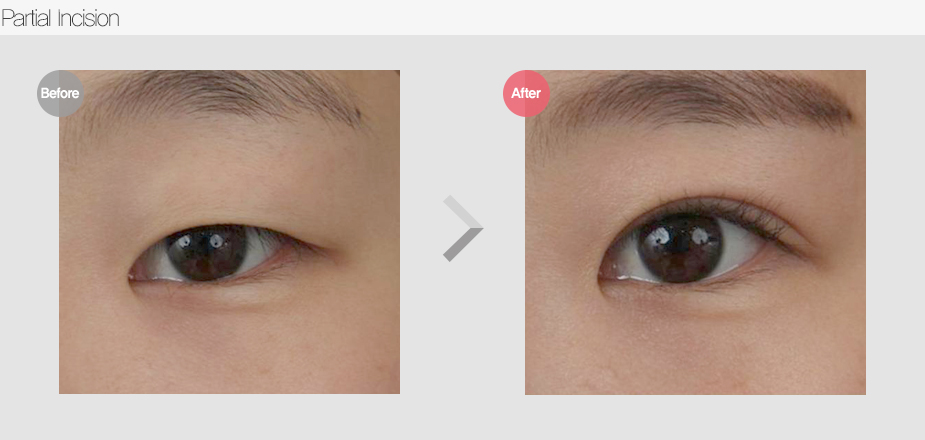 Before & After