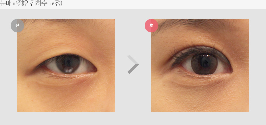 Before & After