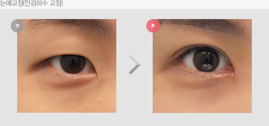Before & After