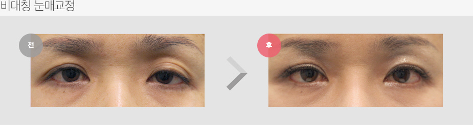 Before & After