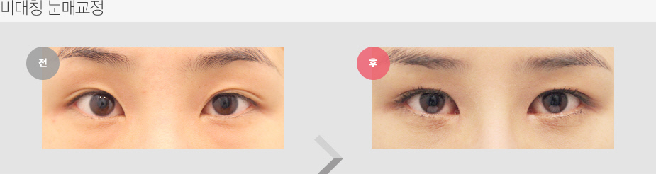Before & After