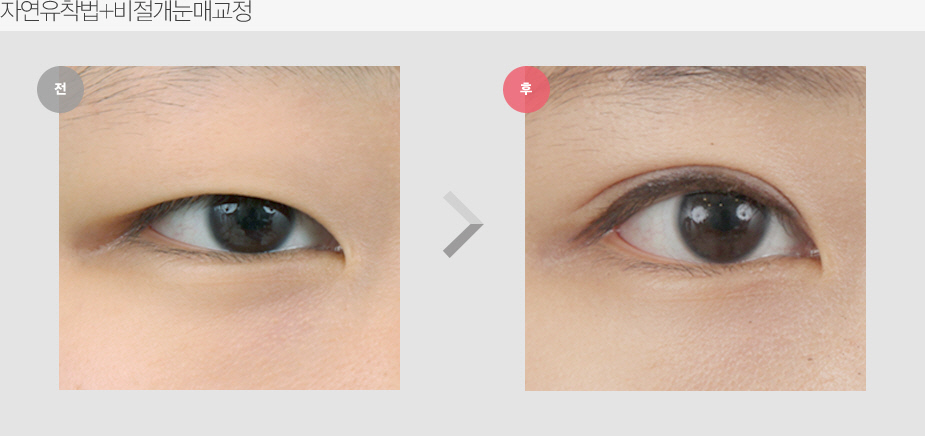 Before & After